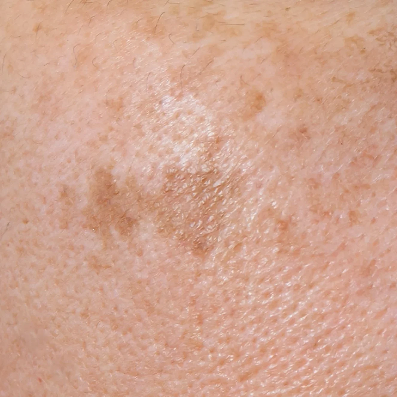 Pelle con macchie e imperfezioni.