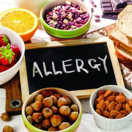 allergeni-alimentari-normativa
