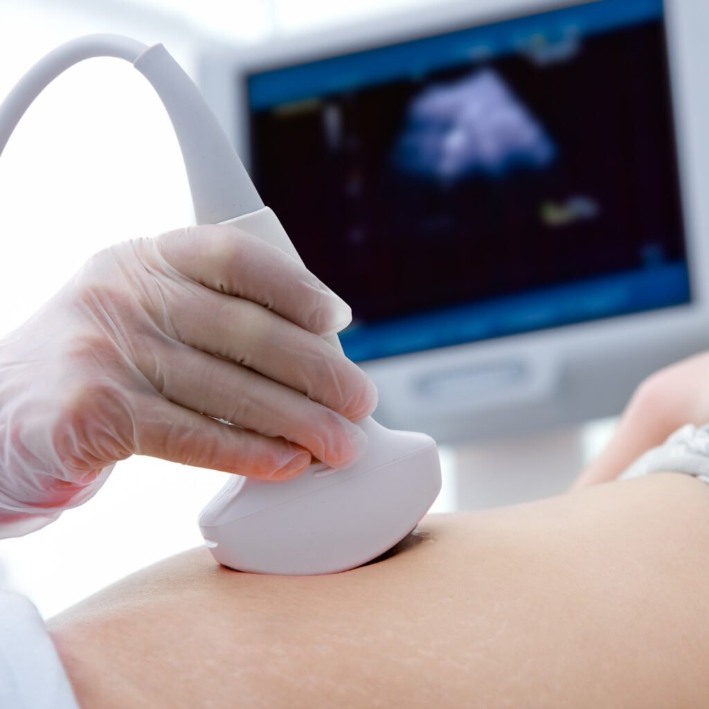 ecografia